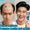 Sumifun Hair Growth Cream – Anti Hair Loss & Regrowth Cream for Men & Women
