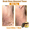 South Moon Bee Venom Pain Relief Cream for Arthritis, Muscle & Joint Discomfort (Original)
