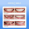 Removable White Teeth Veneers Covers Gaps, Yellow, Missing & Crooked Teeth - One Size Fits All, No Dentist Needed