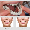 Removable White Teeth Veneers Covers Gaps, Yellow, Missing & Crooked Teeth - One Size Fits All, No Dentist Needed